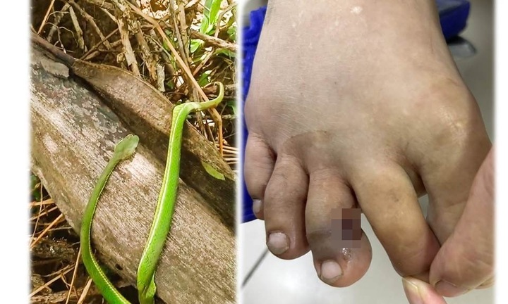 Tai nạn kinh hoàng trong vườn nhà khiến người phụ nữ nhập viện cấp cứu