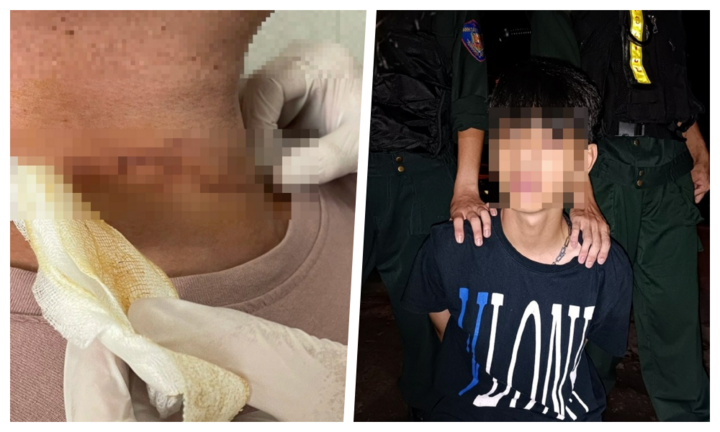 Vụ thanh niên bị tấn công, cướp khi tắm biển ở Phú Quốc: Bất ngờ lời khai