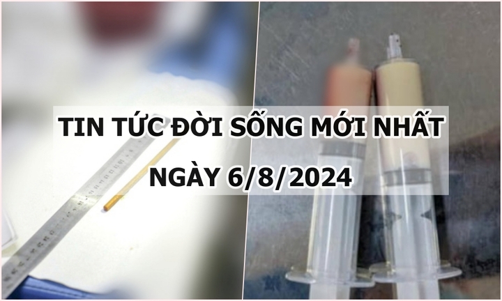 Tin tức đời sống ngày 6/8/2024: Phát hiện vật khó tin ở tá tràng nam thanh niên
