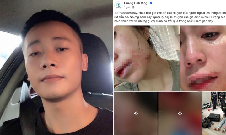 Động thái gây chú ý của Quang Linh Vlogs khi Hằng Du Mục bị chồng đánh đập dã man