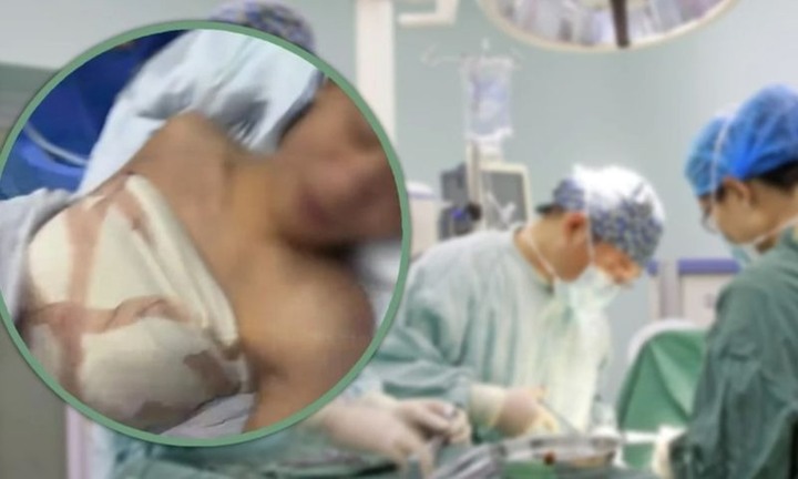 Thẩm mỹ viện dụ dỗ chàng trai thiểu năng nâng ngực khiến dân tình phẫn nộ