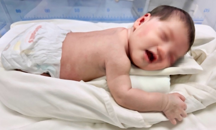 Bé sơ sinh bị bỏ rơi với hàng trăm con giòi trên cơ thể: Phép màu kỳ diệu