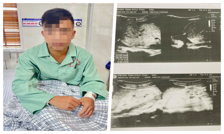 Đau đầu mệt mỏi kéo dài, đi khám phát hiện suy thận mạn giai đoạn cuối