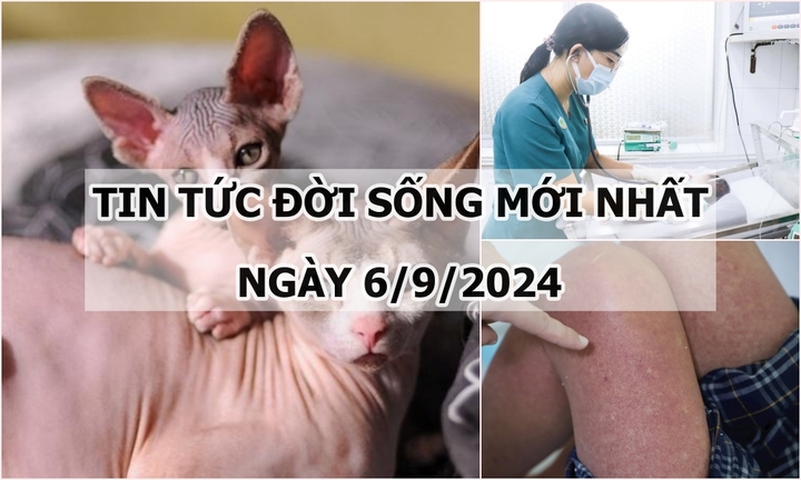 Tin tức đời sống 6/9/2024: Hé lộ giống mèo có tuổi thọ ngắn nhất thế giới