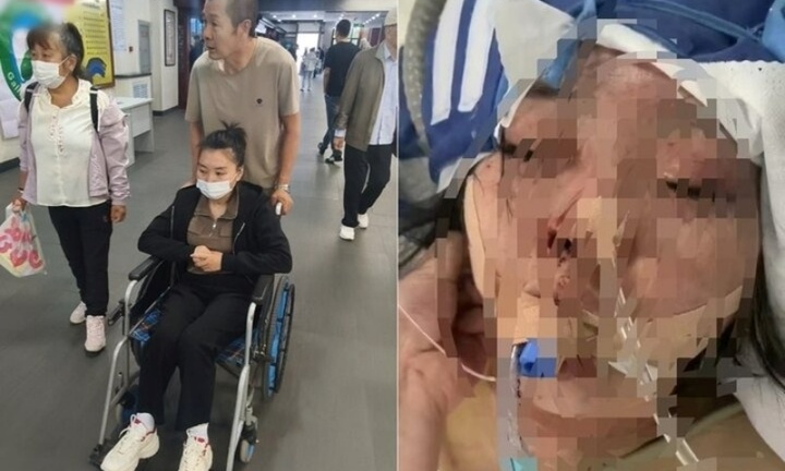 Chồng đánh vợ mù mắt vì lý do không ngờ, hành động của mẹ chồng càng gây phẫn nộ