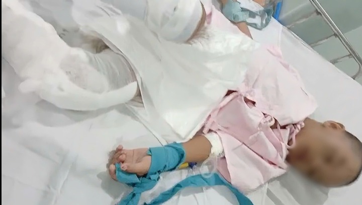 Vụ bé trai 6 tuổi nghi bị bạo hành, cơ thể bỏng rộp: Bệnh viện nói gì?