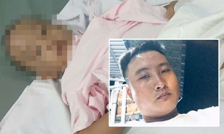 Vụ bé trai 6 tuổi bị bạo hành dã man ở TP.HCM: Bắt người cha và “vợ hờ”