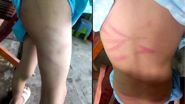 Vụ bé 6 tuổi bị mẹ ruột đánh đập dã man ở Hậu Giang: Hé lộ nguyên nhân