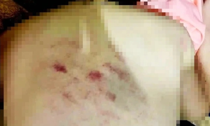 Vụ nữ giáo viên bị 