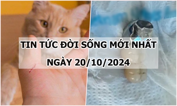 Tin tức đời sống 20/10/2024: Người đàn ông tử vong sau gần 1 năm bị mèo cắn