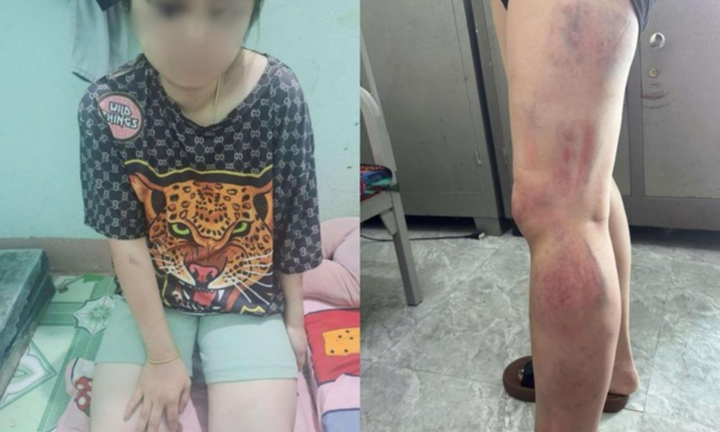 Vụ người phụ nữ bạo hành suốt 13 giờ: