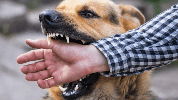 Bị chó dại cắn nhưng không tiêm vaccine , bé trai 7 tuổi tử vong