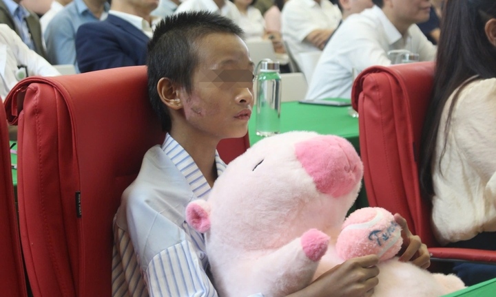 50 ngày “chiến đấu ngoan cường” để giành giật sự sống của bé gái Làng Nủ, Lào Cai