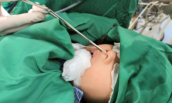 Bệnh nhi nhập viện điều trị vì “răng” mọc lạc ở chỗ không ai nghĩ đến