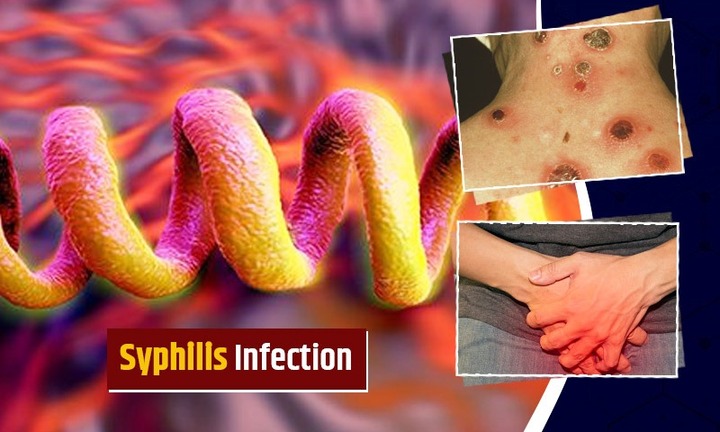 Thấy mắt mờ, đi khám phát hiện mắc bệnh giang mai ở nơi khó ai ngờ tới