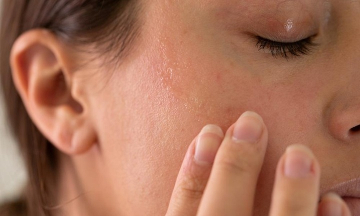 9 dấu hiệu bất ngờ trên da báo hiệu bệnh thận, không phải ai cũng biết