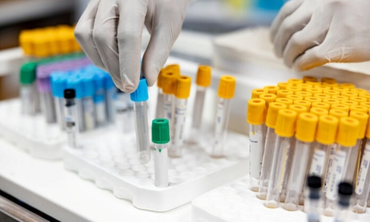 Hơn 300 lọ chứa virus nguy hiểm biến mất khỏi phòng thí nghiệm ở Australia