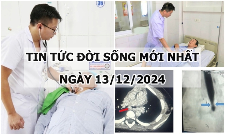 Tin tức đời sống 13/12: Người đàn ông rơi vào hôn mê sau cú ngã thang
