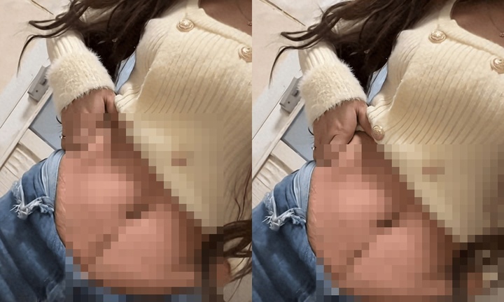 Hình ảnh bụng sau sinh của mẹ 26 tuổi khiến dân mạng 