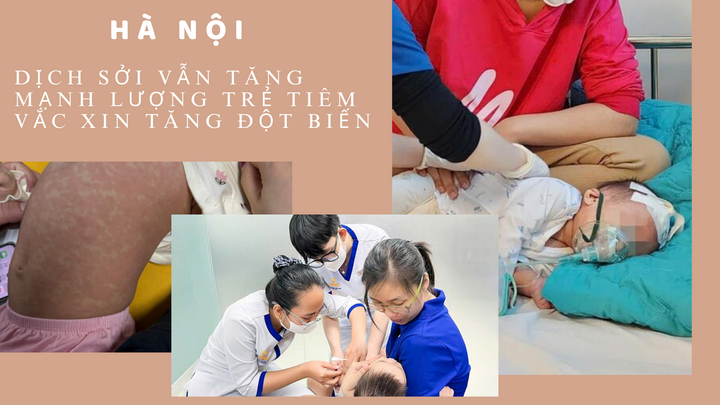 Hà Nội: Dịch Sởi vẫn tăng mạnh, lượng trẻ tiêm vắc xin tăng đột biến