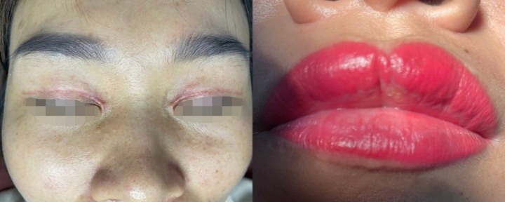 Chị em làm đẹp