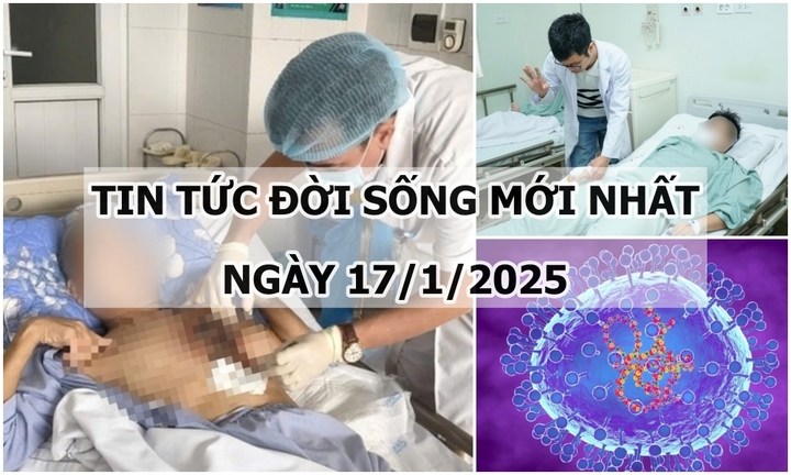 Tin tức đời sống 17/1: Nhiễm loại nấm hiếm gặp, người đàn ông hoại tử vùng ngực