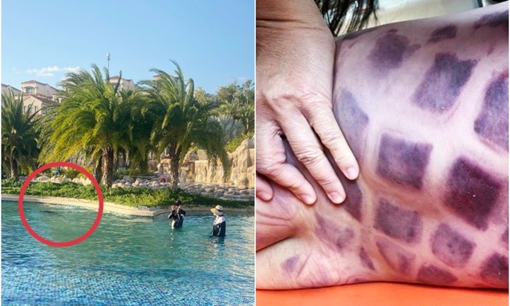 Vụ bé trai người Nhật tử vong ở hồ bơi tại Bình Thuận: Diễn biến mới nhất