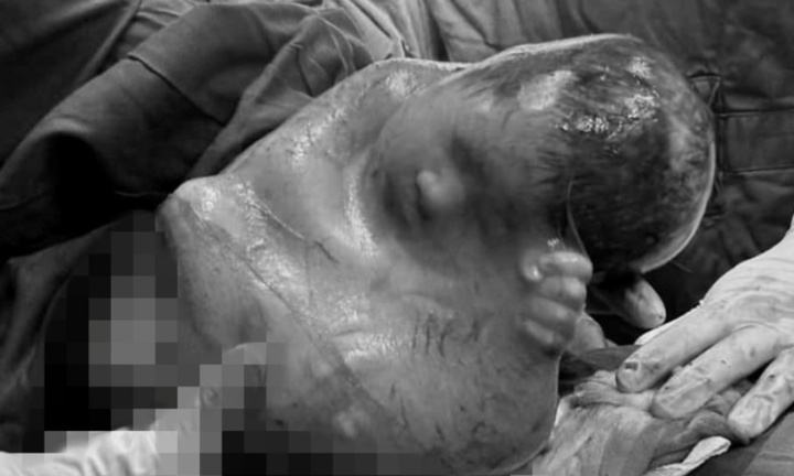 Em bé chào đời trong 