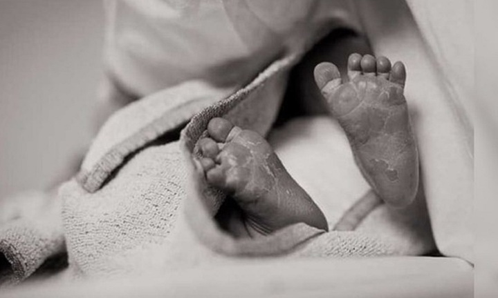 Hi hữu: Phát hiện 2 bào thai trong bụng bé trai 3 ngày tuổi 