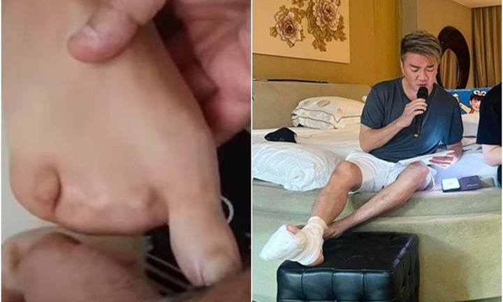 Xôn xao hình ảnh bàn chân thương tật của ca sĩ Đàm Vĩnh Hưng