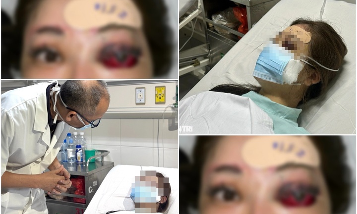 Gọi người đến nhà tiêm filler, cô gái trẻ 29 tuổi mù vĩnh viễn