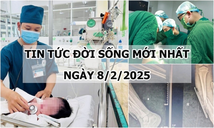 Tin tức đời sống 8/2: Cứu sống bé sơ sinh bị thủng đường tiêu hóa kèm xoắn ruột