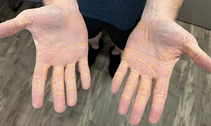 Rùng mình bàn tay 