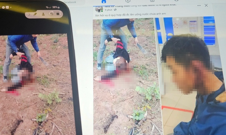 Xác minh vụ 2 vợ chồng bị đánh tới tấp nghi do mâu thuẫn đất đai