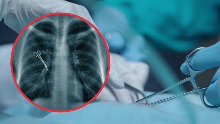 Định mệnh nghiệt ngã từ sai sót y khoa: Bác sĩ để quên kéo trong ổ bụng, người đàn ông tử vong thương tâm