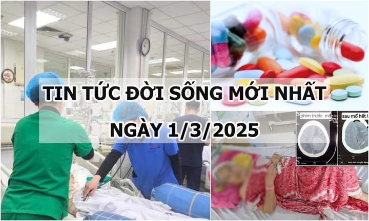 Tin tức đời sống 1/3: Hơn 5 giờ phẫu thuật bóc tách khối u não cho người phụ nữ