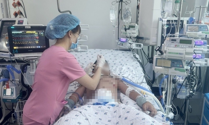 Bé 11 tuổi suy hô hấp, xuất huyết tiêu hóa sau 3 ngày sốt cao liên tục