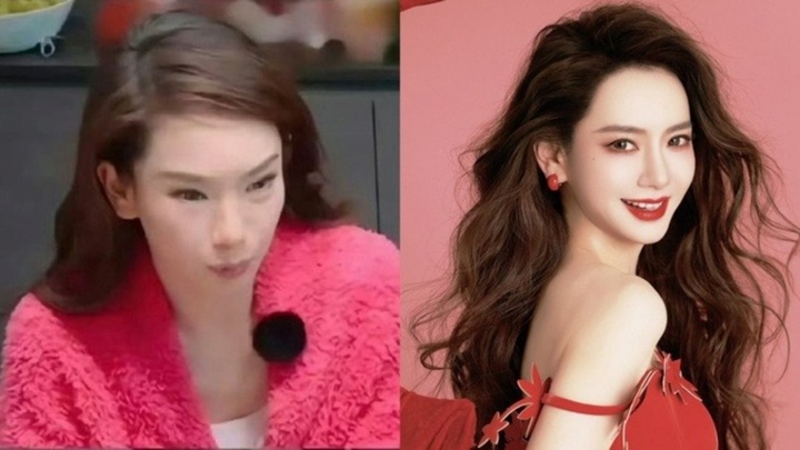 Mặt biến dạng do tiêm botox, mỹ nhân nổi tiếng bộc bạch: Đến tôi còn hết hồn, kinh hãi!