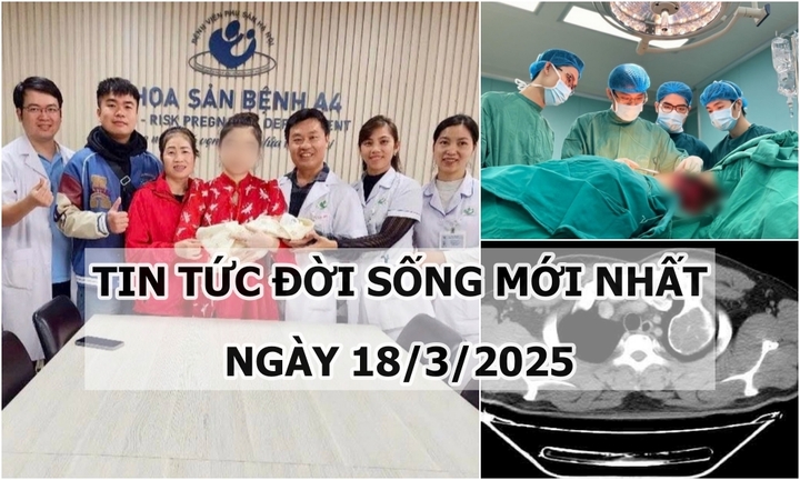 Tin tức đời sống 18/3: Đau nhẹ vùng vai trái, đi khám phát hiện khối u xương