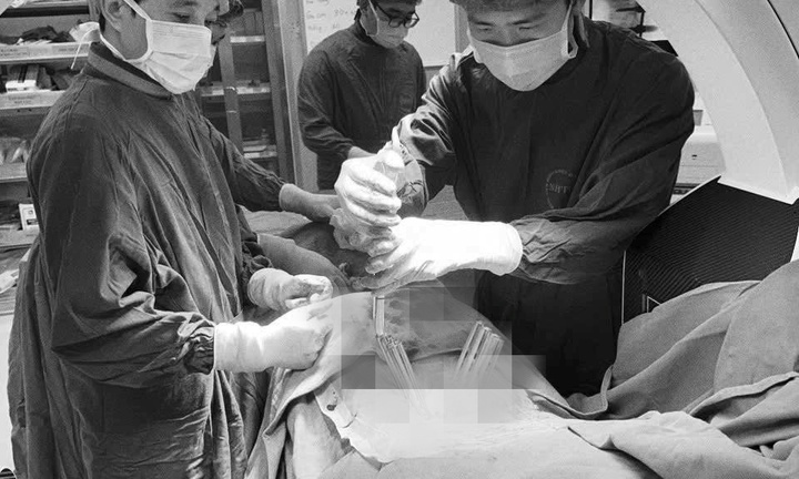 Cứu sống người phụ nữ sau cú ngã 4m, mất hoàn toàn khả năng vận động