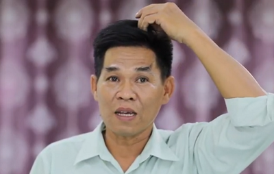 Chia sẻ thật – Kinh nghiệm đánh bay vảy nến hiệu quả sau nhiều năm 