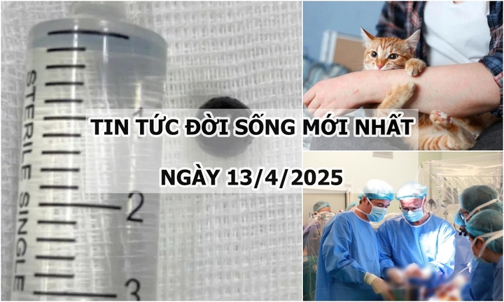 Tin tức đời sống 13/4: Viên đạn kim loại bị “bỏ quên” trong hốc mũi suốt 5 năm