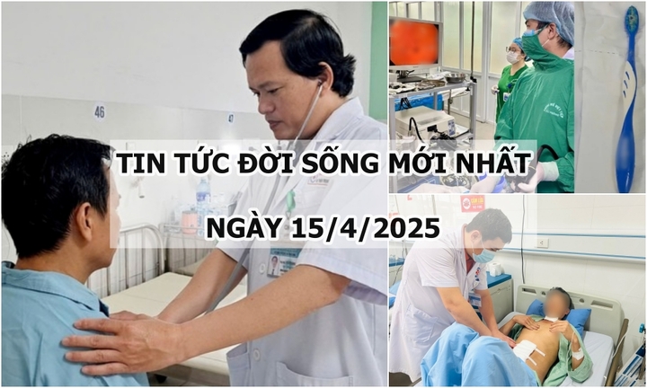 Tin tức đời sống 15/4: Bàn chải dài 17cm mắc kẹt trong thực quản người phụ nữ