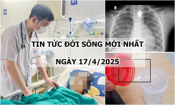 Tin tức đời sống 17/4: Gia đình xin đưa về lo hậu sự, cụ bà bất ngờ có phản xạ, thoát “cửa tử”