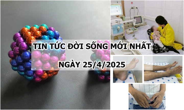 Tin tức đời sống 25/4: Món đồ khiến 2 em bé phải nhập viện phẫu thuật