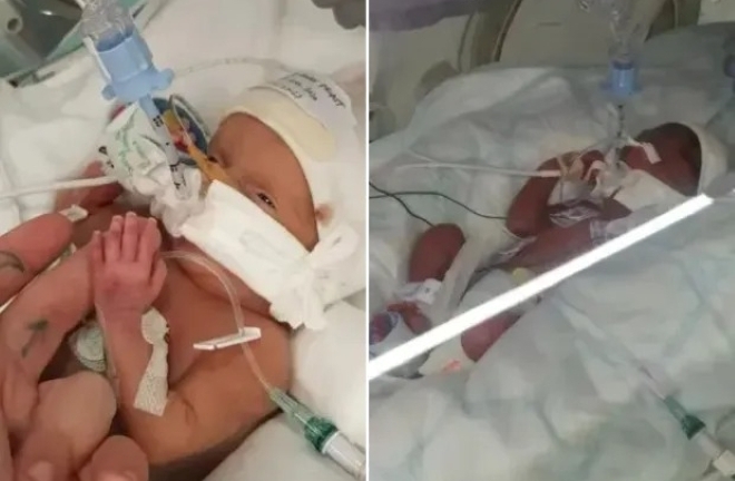 Định mệnh nghiệt ngã từ sai sót y khoa Đông-Tây: Bị truyền nhầm chất bảo quản thực phẩm, 2 bé sơ sinh tử vong