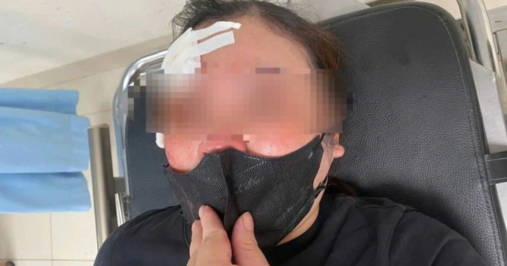 Vụ nữ tài xế bất ngờ bị người đàn ông đi ô tô dùng dùi cui vụt vào đầu: Hé lộ nguyên nhân