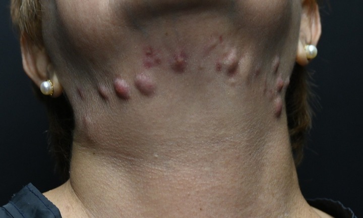 Bi hài hậu vận sau thẩm mỹ: