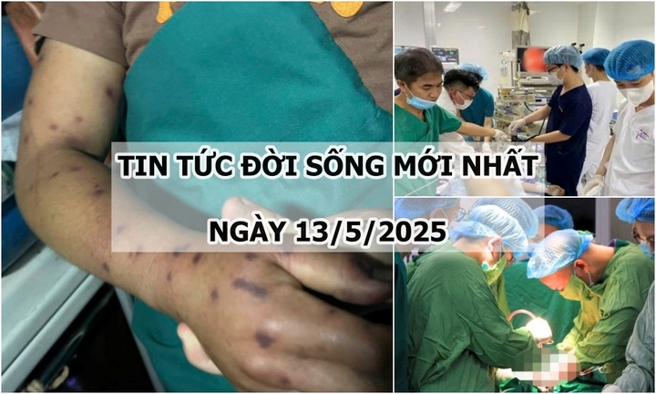 Tin tức đời sống ngày 13/5: Người đàn ông khó thở, tức ngực sau khi bị ong đốt hơn 150 vết