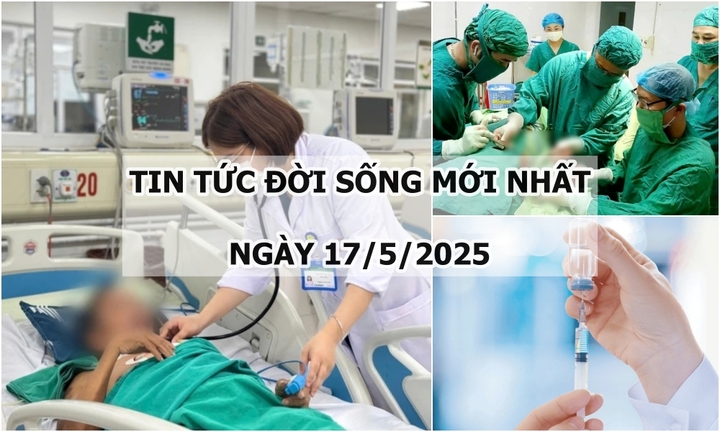 Tin tức đời sống 17/5: Nhiễm nấm, bệnh nhân 42 tuổi bị viêm màng não nguy kịch